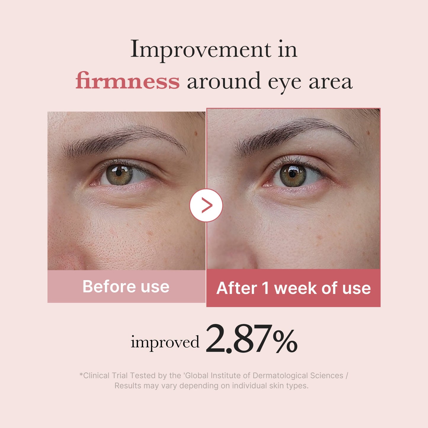 Medicube PDRN Pink Peptide Eye Cream 30ml
