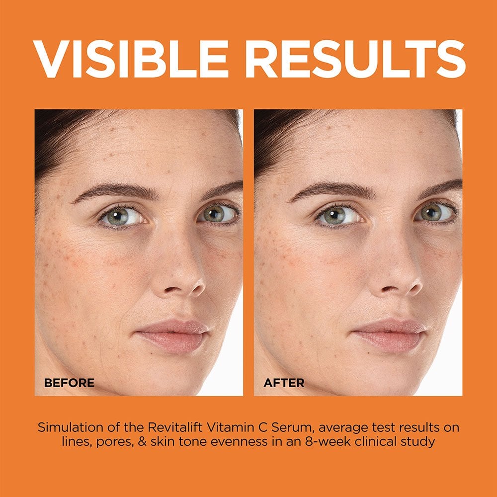 L'Oréal Revitalift 12% Pure Vitamin C + E + Salicylic Acid Serum