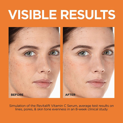 L'Oréal Revitalift 12% Pure Vitamin C + E + Salicylic Acid Serum