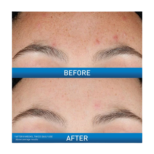 CeraVe Resurfacing Retinol Serum