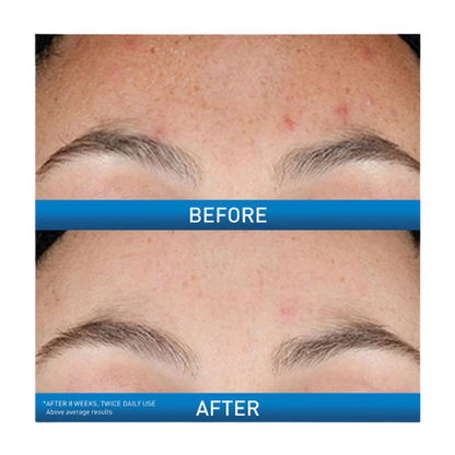 CeraVe Resurfacing Retinol Serum